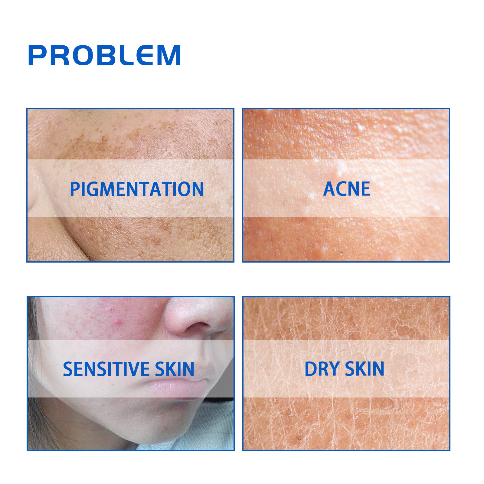 HOYGI Blueberry Facial Care Facial Skin Deep Cleansing Anti-Wrinkle Skin Care Essence Beauty Brightening Cream